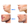 ZESTAW DO ĆWICZEŃ ŻUCHWY I SZCZĘKI JAWLINE 3 GUMY